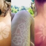 Why Sunburn Tattoos Aren’t Really Cool