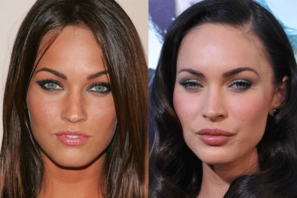 5 A-Listers that got botox (and are all the better for it) | Cool Buzz